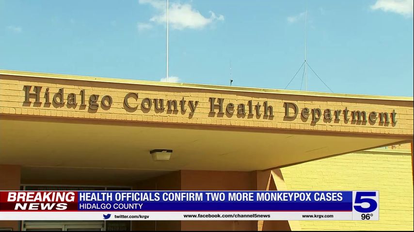 Two additional cases of monkeypox confirmed in Hidalgo County