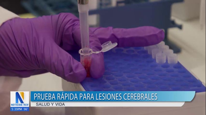 Impulsan innovadora prueba rápida para lesiones cerebrales