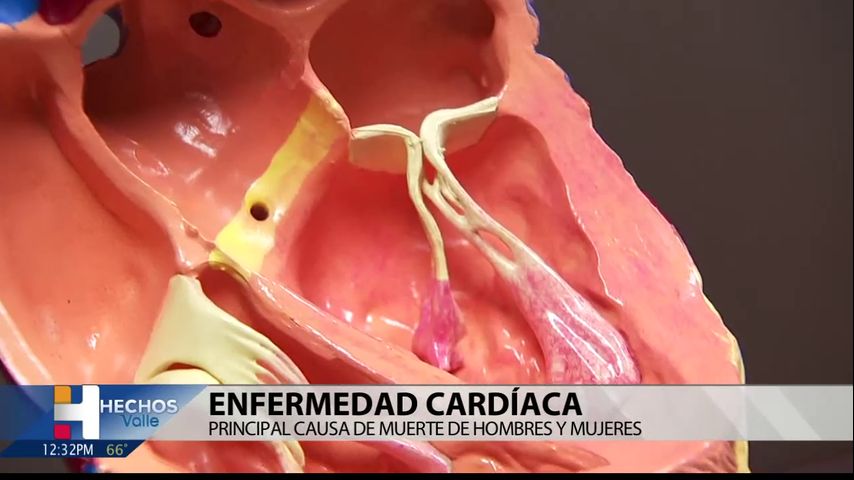 Corazón del Valle: Enfermedad cardiaca y como mantener la salud del corazón