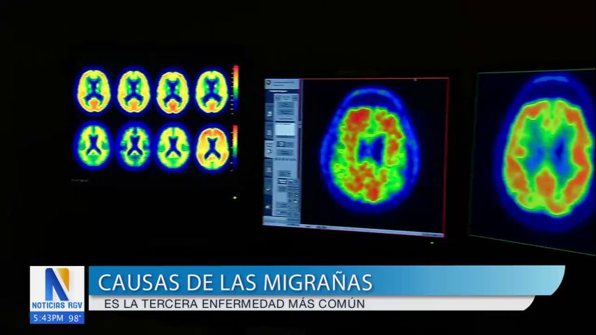 Salud y Vida: La migraña es la tercera enfermedad más común en Estados Unidos