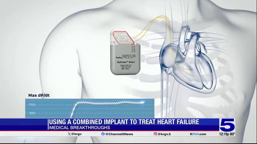 Medical Breakthroughs: New implant helping treat heart failure