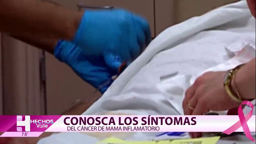 Conozca los síntomas de cáncer de mama inflamatorio