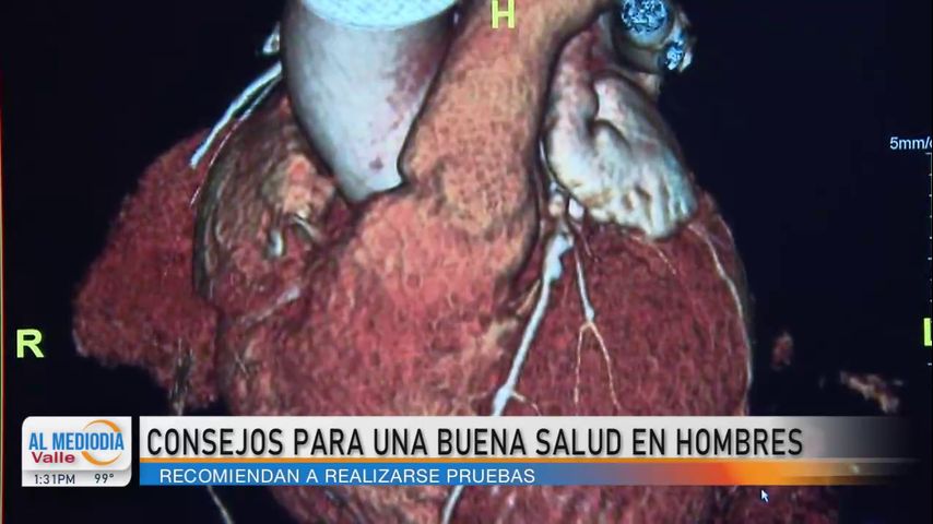 Su Salud Importa: Maneras en que los hombres deben cuidar de su salud