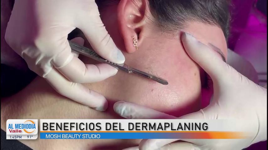 La Entrevista: Los beneficios del dermaplaining y otros tratamientos para el cuidado estético de la piel