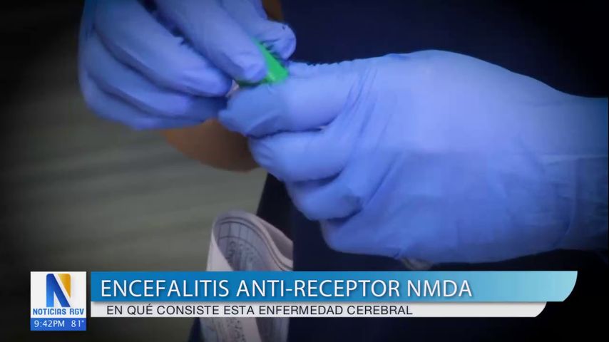 Salud y Vida: Encefalitis Anti-Receptor NMDA, un ataque cerebral que puede afectar a cualquiera.