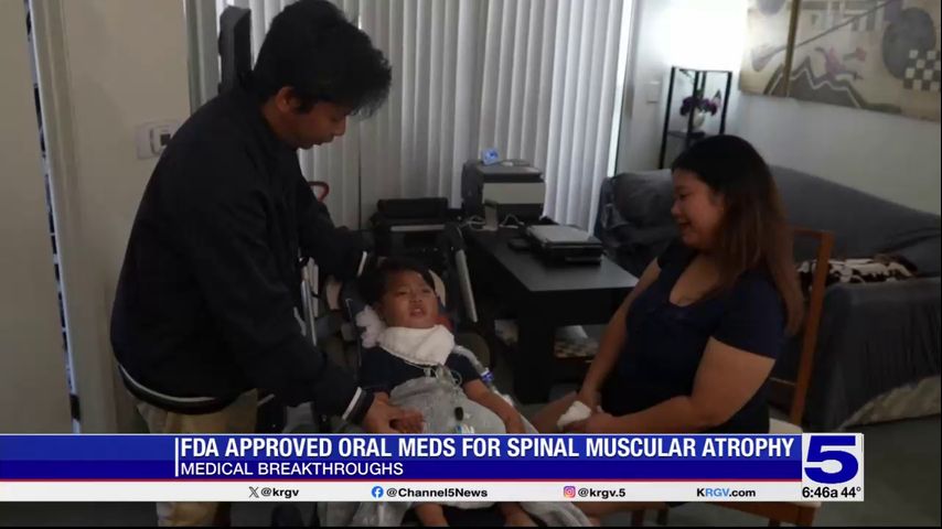 Medical Breakthrough: FDA approved oral medication for Spinal Muscular Atrophy