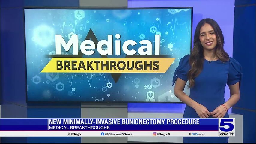 Medical Breakthrough: New minimally-invasive bunionectomy procedure
