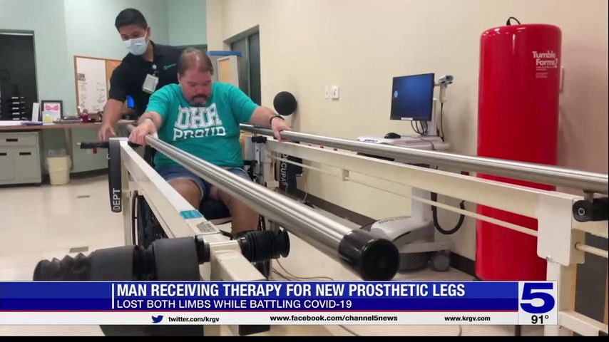 Man who became a double amputee due to Covid receiving therapy for new prosthetic legs