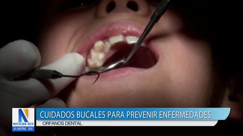 Cuidados bucales para prevenir enfermedades