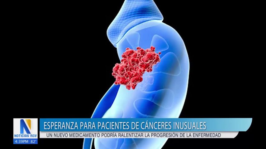 Salud y Vida: FDA aprueba nuevo medicamento contra el cáncer urotelial