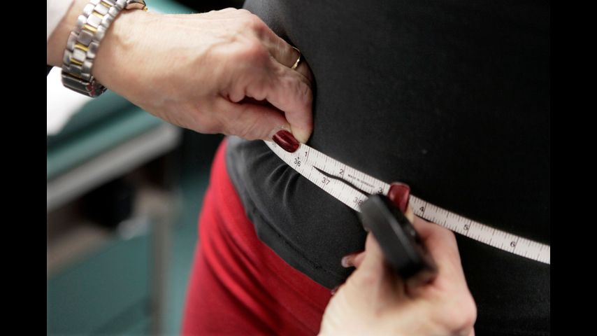 Severe obesity is on the rise in the US